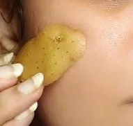 Does applying potato on the face reduce blemishes? Find out