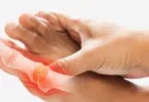 It is very important for uric acid patients to take special care of their diet.